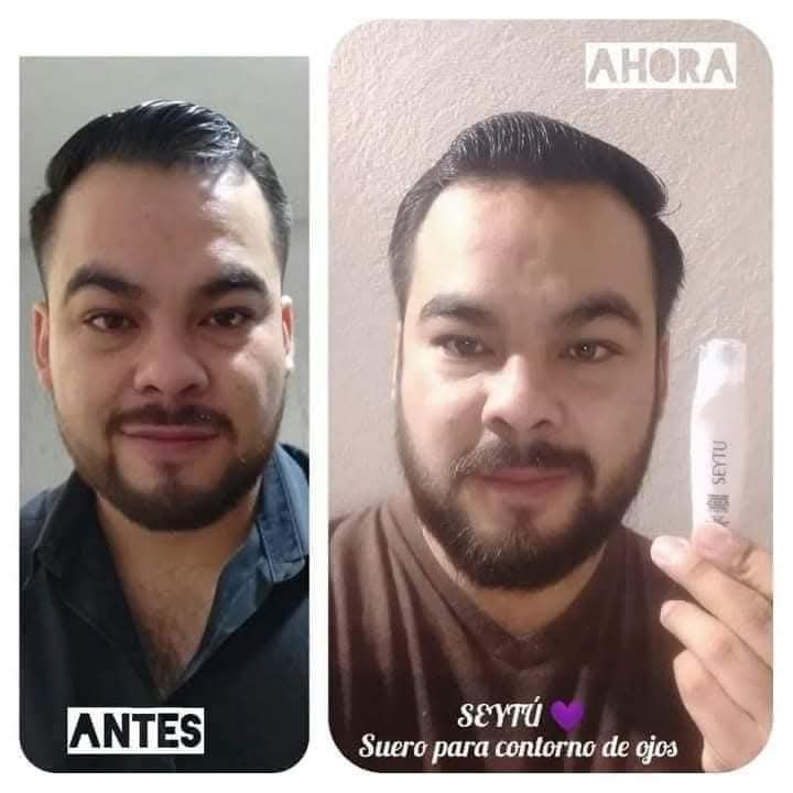 Roller Pro - Serum para el Contorno de Ojos